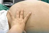Thiếu nữ 19 tuổi bụng to như bầu, bác sĩ phát hiện bí mật "đáng sợ" bên trong