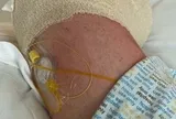 Người phụ nữ phải cắt cụt chân sau khi dẫm vào thức ăn cho chó cưng: Chuyện gì đã xảy ra?