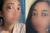 Nhìn đôi mắt "ếch" của người phụ nữ, ai cũng thương, câu chuyện phía sau là bài học cảnh tỉnh nhiều người trẻ