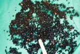 Đau bụng suốt nhiều tháng, người đàn ông 43 tuổi sốc nặng khi bác sĩ gắp ra thứ "đáng sợ" trong bụng