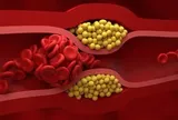 Không cần thực phẩm đắt tiền, bác sĩ chỉ 4 món quen thuộc giúp giảm cholesterol “cực đỉnh”