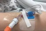 Bé gái 12 tuổi chẳng làm gì cũng mệt rã rời, mẹ cho đi khám mới phát hiện tất cả các cơ quan đều thiếu 1 thứ…