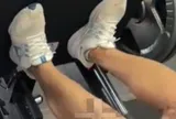 Nam thanh niên 23 tuổi suy thận cấp sau khi tập gym, chỉ số tổn thương cơ tăng gấp 100 lần