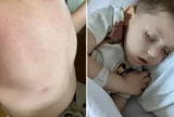 Nam shipper 38 tuổi bật khóc: "Bác sĩ nói vết ngứa trên da con tôi không đáng lo, 3 tuần sau lại bảo là ung thư"