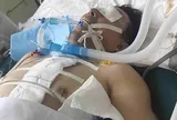 Người đàn ông nguy kịch vì trắng xóa cả 2 bên phổi: Bác sĩ cảnh báo 1 kiểu dùng điều hòa ngang "tự sát"