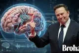 Elon Musk và hành trình gắn chip vào não người: Tư tưởng của thế hệ đàn ông bản lĩnh không đầu hàng trước lão hóa, bệnh tật