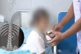 Bé gái 5 tuổi 2 năm không cao thêm, không tăng cân, đi khám bác sĩ phát hiện 1 thứ phủ đầy thận trái