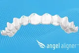 Phán Quyết của Tòa Án Paris về Tính Năng Đã Ngừng Cung Cấp Sẽ Ít Ảnh Hưởng đến Khách Hàng của Angelalign