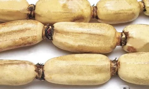 2 loại củ dễ là “ổ ký sinh trùng" mắt thường không thấy được, loại đầu bảng nhiều người mê