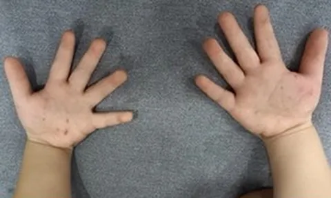 Con đang chơi bỗng khóc ngặt nghẽo, mẹ sững sờ khi phát hiện “bí mật”