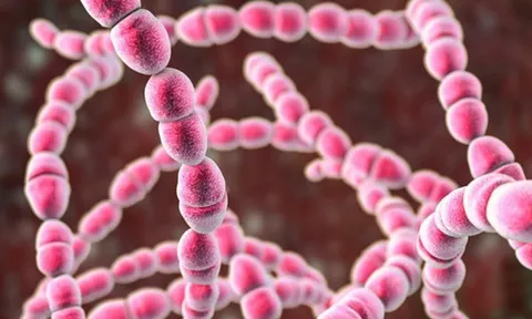 Bé 11 tuổi đột ngột co giật, bác sĩ “sốc” khi phát hiện thủ phạm quen thuộc