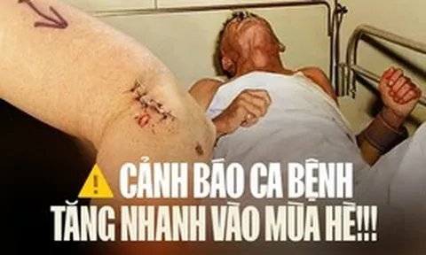 1 căn bệnh đang tăng mạnh, đã có 13 ca không qua khỏi chỉ trong 3 tháng đầu năm: Bác sĩ Bệnh viện Bạch Mai cảnh báo khẩn