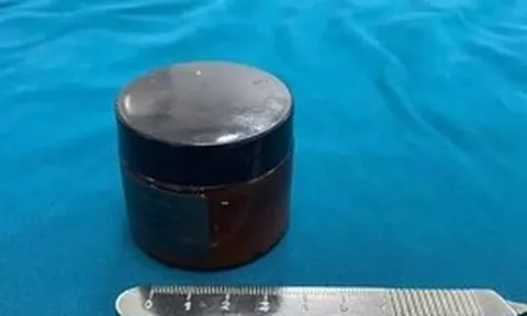 Người đàn ông hoảng loạn khi hũ mỹ phẩm chui tọt vào trực tràng