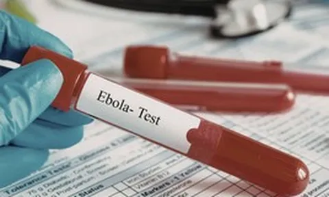 TPHCM tăng cường giám sát cửa khẩu, chủ động phòng nguy cơ dịch bệnh Ebola xâm nhập
