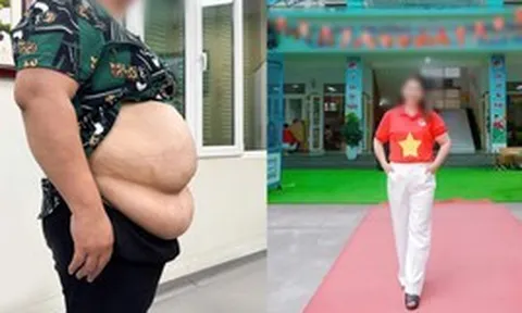 Bị từ chối hút mỡ vì quá béo, cô giáo mầm non 101kg “lột xác” theo cách không ngờ