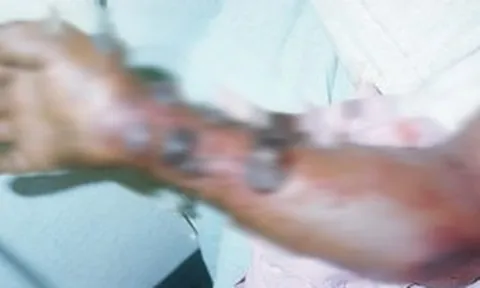 Vì sao WHO đánh giá nguy cơ Ebola vào Việt Nam ở mức thấp?