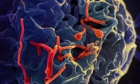 Bộ Y tế đánh giá về nguy cơ dịch Ebola đối với Việt Nam