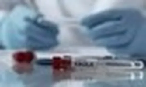 Bộ Y tế hoả tốc yêu cầu các bệnh viện tăng cường phòng chống dịch Ebola