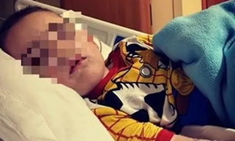 Bé trai 9 tuổi đột ngột suy thận cấp vì kiểu "thương cho roi cho vọt" từ người mẹ