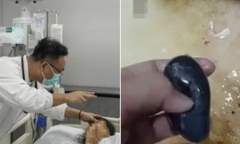 Người phụ nữ suy gan cấp vì mẹo dân gian chữa đau đầu, bác sĩ nói thẳng: Phần này của cá độc hơn thạch tín!