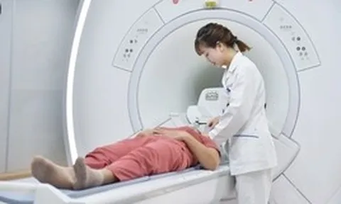 Người phụ nữ 44 tuổi đi khám đau đầu, bác sĩ bất ngờ khi nhìn kết quả chụp não