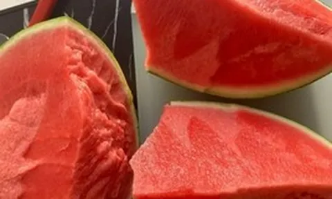 Cụ ông phổi trắng xóa, thận "ngừng hoạt động" sau khi ăn dưa hấu giải nhiệt