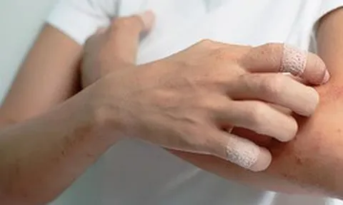 Thức khuya, ăn đồ ăn giao tận nhà suốt nhiều năm, người phụ nữ ân hận nhận "tin dữ" ung thư