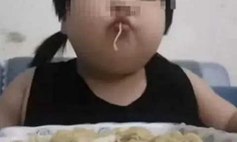 Bé gái 8 tuổi đã nặng 45kg, gan nhiễm mỡ nặng vì mỗi bữa đều ăn quá nhiều 1 món mâm cơm gia đình nào cũng có