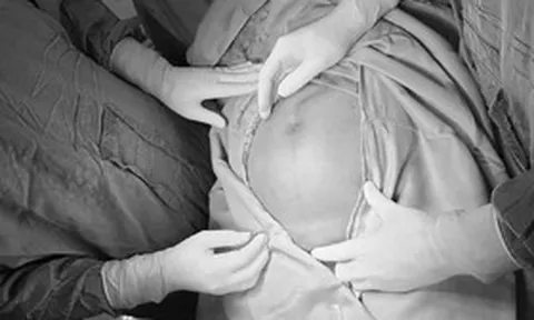 Bụng to nhanh bất thường, người phụ nữ "sốc" khi biết bí mật trong cơ thể