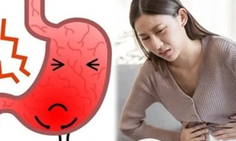 Cảnh báo: Không phải đồ ăn cay, đây mới là 4 "thủ phạm" gây ung thư dạ dày phổ biến nhất
