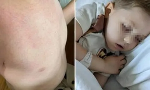 Nam shipper 38 tuổi bật khóc: "Bác sĩ nói vết ngứa trên da con tôi không đáng lo, 3 tuần sau lại bảo là ung thư"