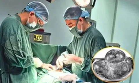 Bụng phình to bất thường, sự thật bác sĩ nói ra khiến người phụ nữ sốc nặng