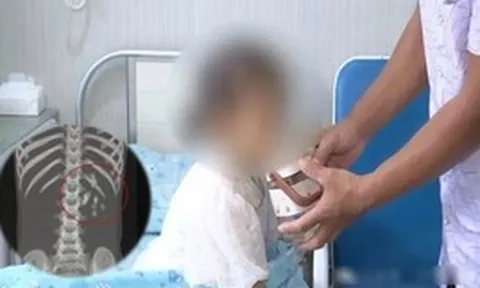 Bé gái 5 tuổi 2 năm không cao thêm, không tăng cân, đi khám bác sĩ phát hiện 1 thứ phủ đầy thận trái