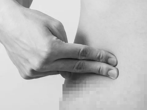 Đau bụng âm ỉ, người đàn ông suýt mất mạng vì thứ "đáng sợ" bên trong