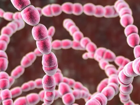 Bé 11 tuổi đột ngột co giật, bác sĩ “sốc” khi phát hiện thủ phạm quen thuộc