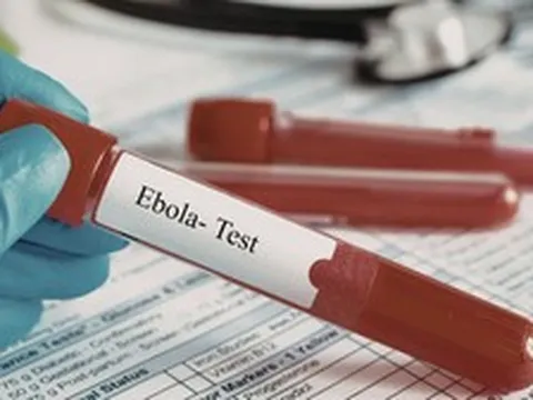 TPHCM tăng cường giám sát cửa khẩu, chủ động phòng nguy cơ dịch bệnh Ebola xâm nhập