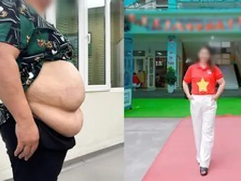 Bị từ chối hút mỡ vì quá béo, cô giáo mầm non 101kg “lột xác” theo cách không ngờ