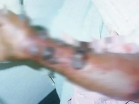 Vì sao WHO đánh giá nguy cơ Ebola vào Việt Nam ở mức thấp?