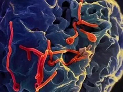 Bộ Y tế đánh giá về nguy cơ dịch Ebola đối với Việt Nam