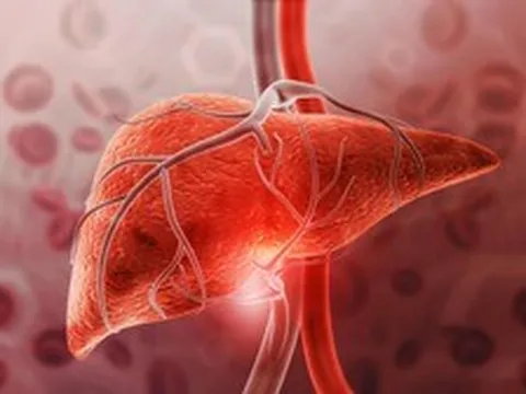 1 thói quen giải khát "bức tử" lá gan: Nhiều người Việt đang làm mỗi ngày