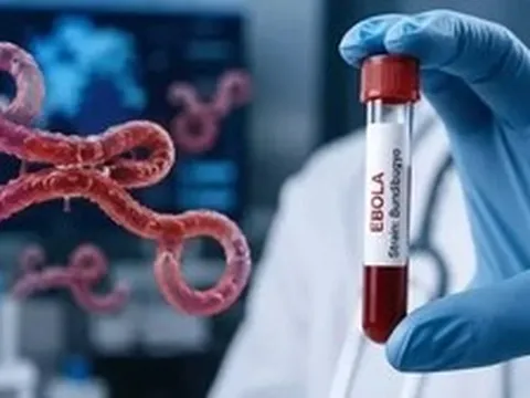 Bộ Y tế kích hoạt giám sát dich Ebola, tăng cường ngăn dịch xâm nhập
