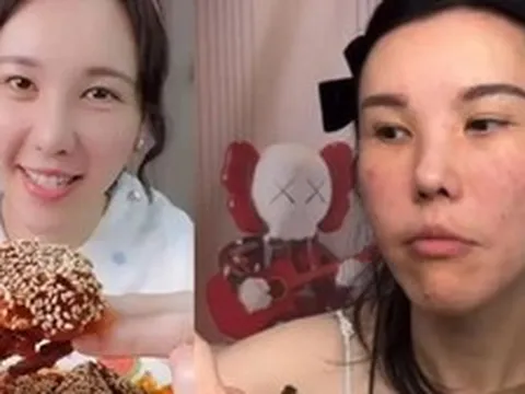 Mặt cô gái trẻ biến dạng sau 2 năm làm mukbang, bác sĩ cảnh báo 4 cái giá phải trả về sức khỏe ít ai biết đến