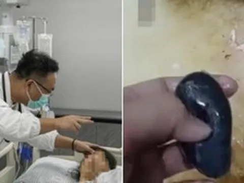 Người phụ nữ suy gan cấp vì mẹo dân gian chữa đau đầu, bác sĩ nói thẳng: Phần này của cá độc hơn thạch tín!