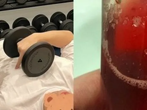 Chàng trai 26 tuổi tiểu ra máu, gan và thận đều tổn thương nặng vì 1 hành động ai cũng tưởng tốt khi giảm cân