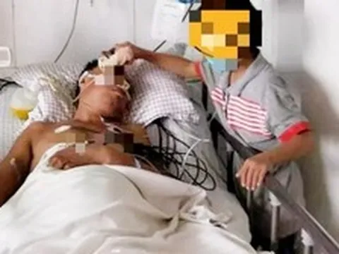 Người đàn ông 49 tuổi đang khỏe mạnh bỗng tử vong vì nhồi máu não, bác sĩ: Ăn xong vội làm 3 việc ngang... tự tử