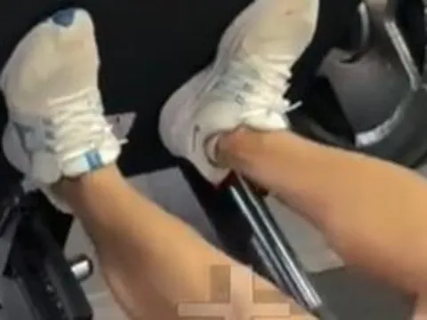 Nam thanh niên 23 tuổi suy thận cấp sau khi tập gym, chỉ số tổn thương cơ tăng gấp 100 lần