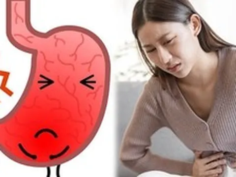 Cảnh báo: Không phải đồ ăn cay, đây mới là 4 "thủ phạm" gây ung thư dạ dày phổ biến nhất