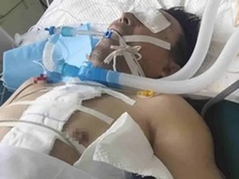 Người đàn ông nguy kịch vì trắng xóa cả 2 bên phổi: Bác sĩ cảnh báo 1 kiểu dùng điều hòa ngang "tự sát"