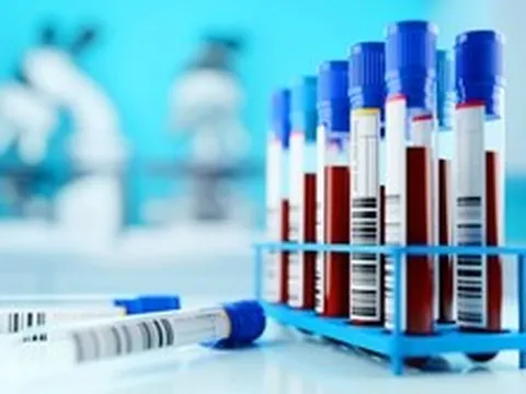 5 xét nghiệm nên làm khi bước sang tuổi 35