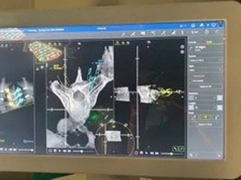 Chàng sinh viên cao 1m86 bị biến dạng toàn bộ cột sống vì một lý do: Bác sĩ cảnh báo người trẻ